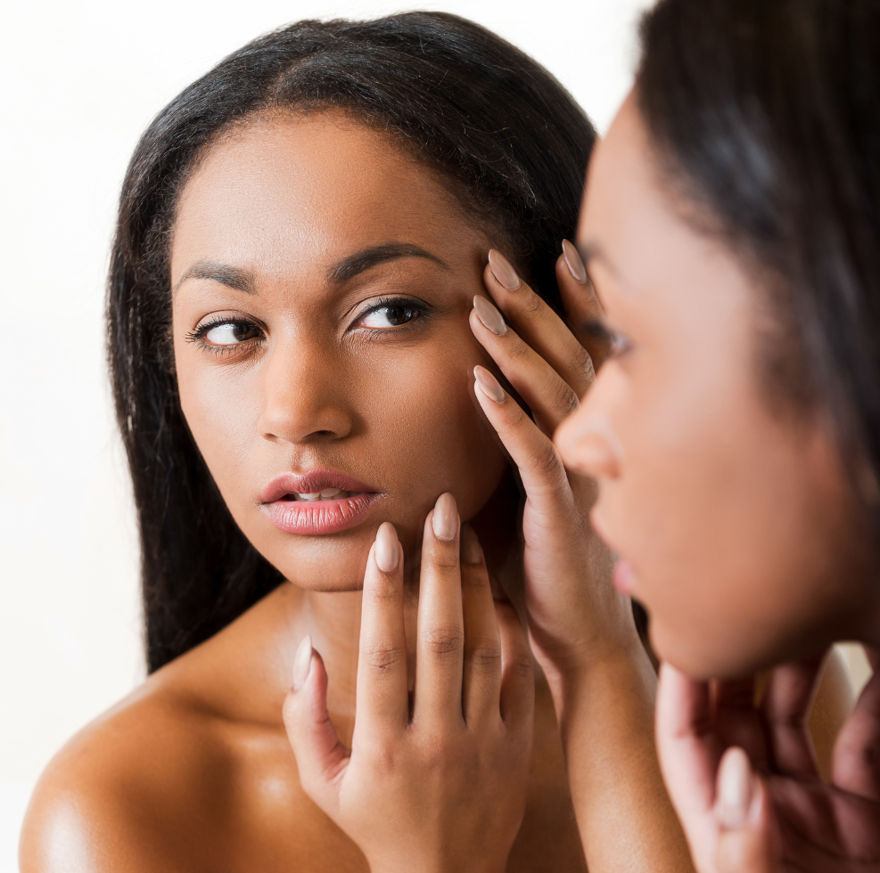 acne and acne scarring